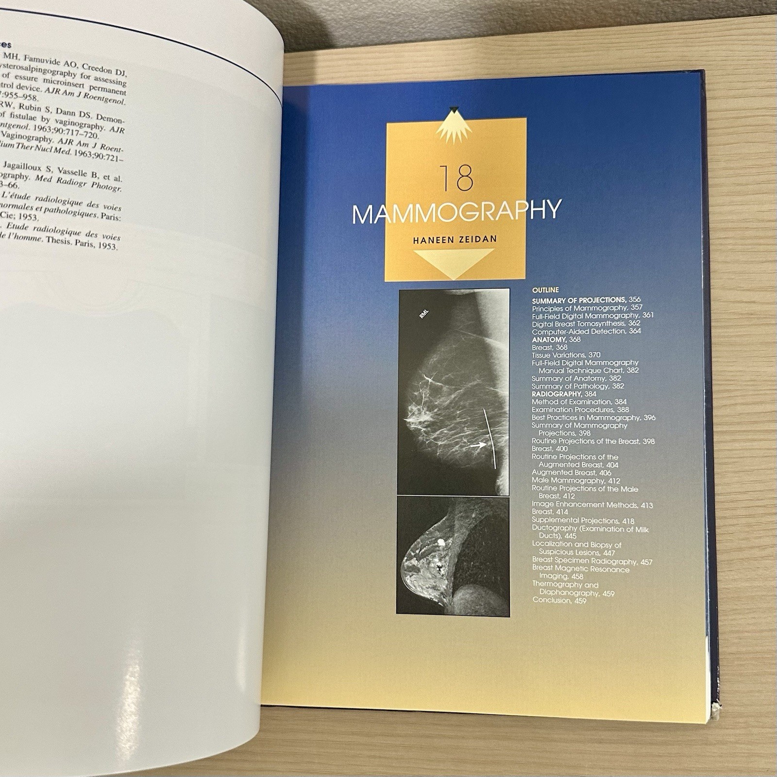 Merrill’s Atlas Of Radiographic Positioning & Procedures VOLUME 2 15th Edition