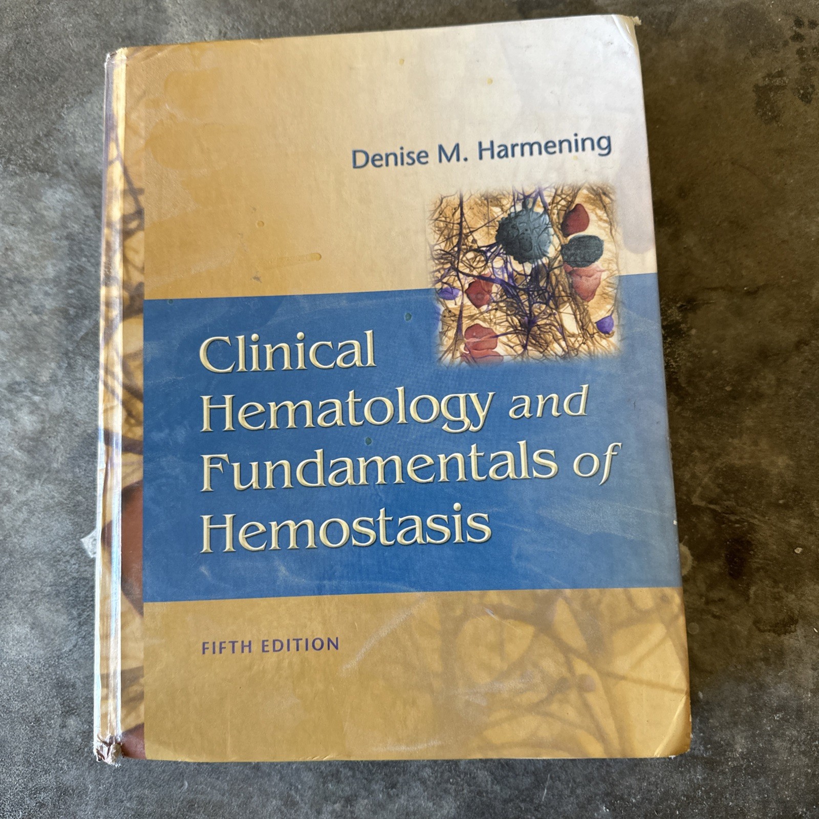 Clinical Hematology and – Hardcover, by Harmening PhD MT – Good