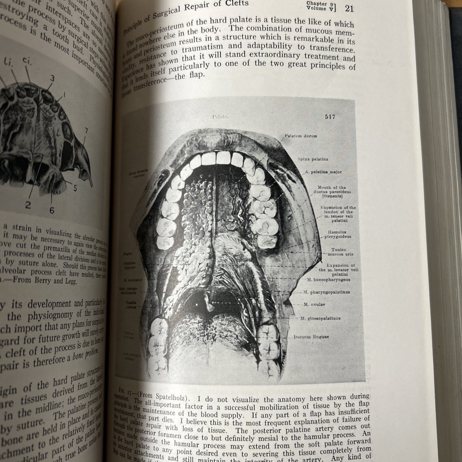 Practice Of Surgery V – Dean Lewis 1930 Pulmonary Lung Chest Plastic Surgery