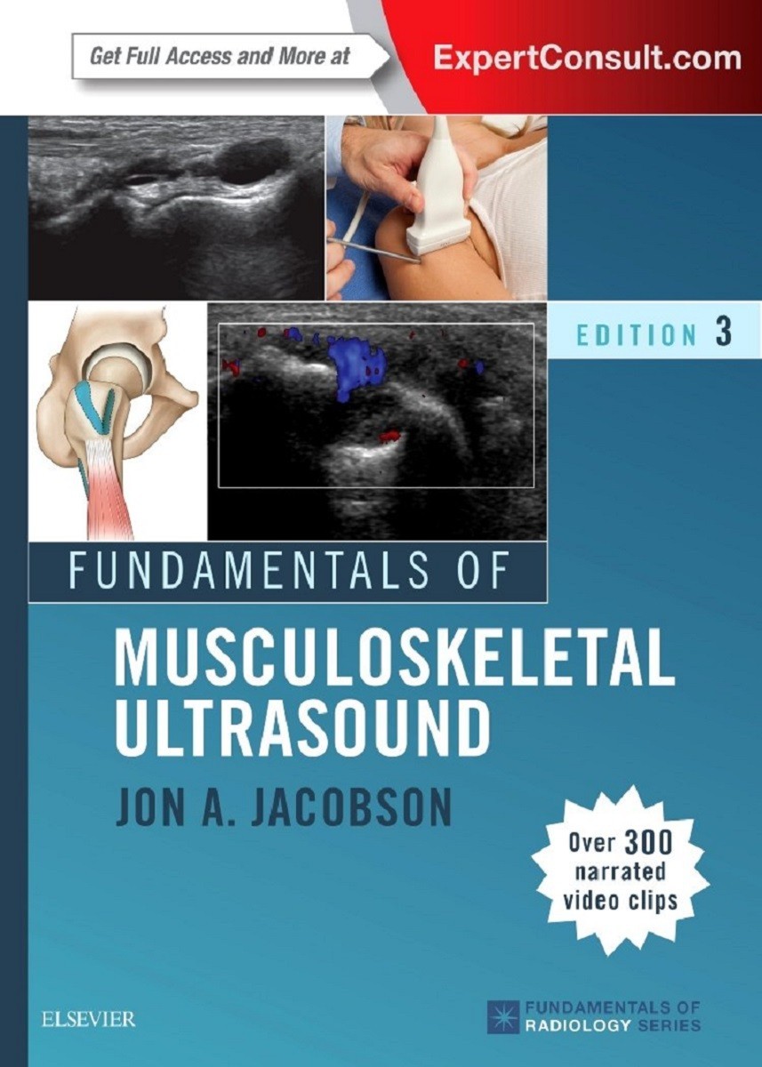 Fundamentals of Musculoskeletal Ultrasound, 3E (English, Paperback)