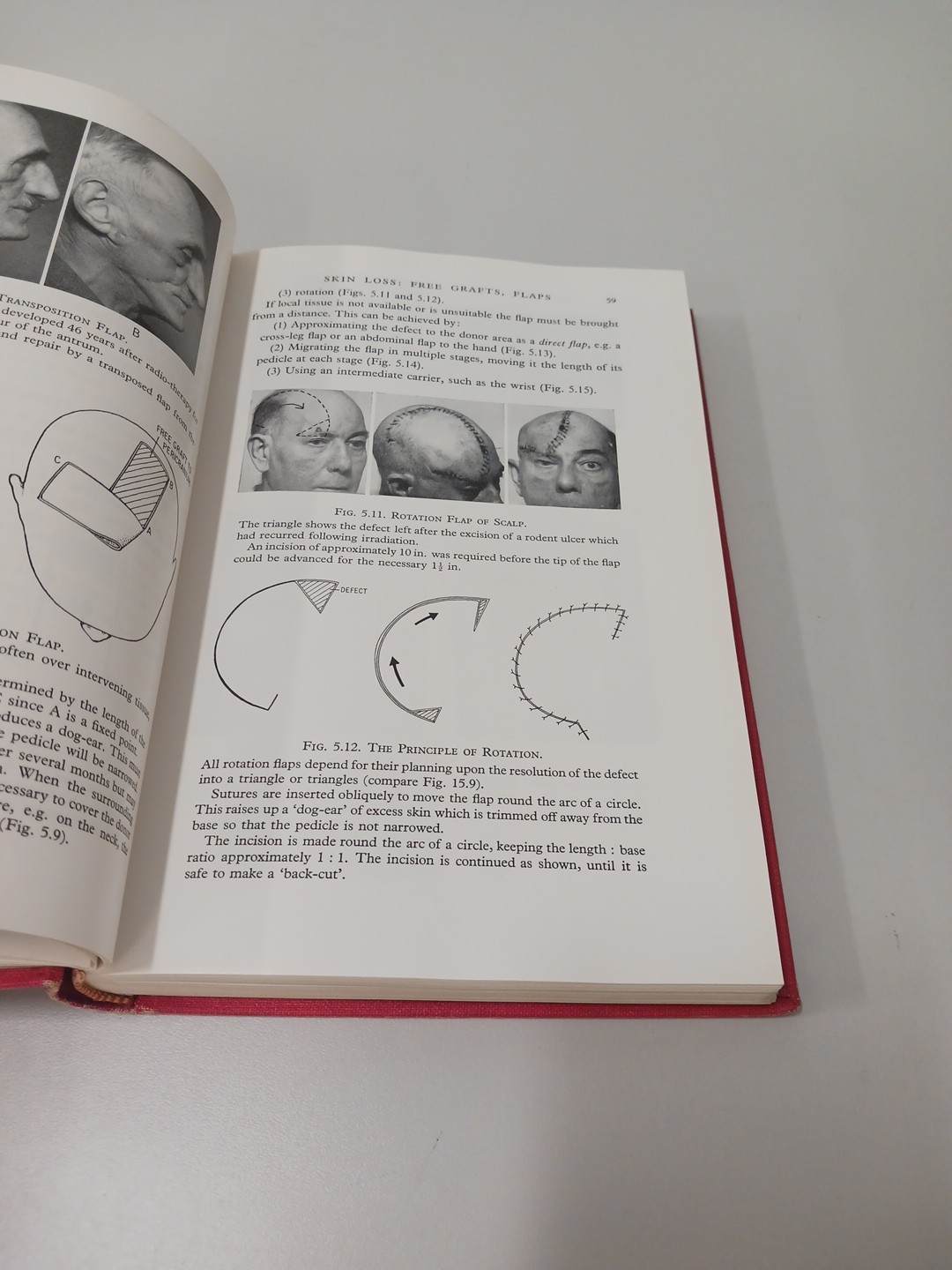 Essentials Of Plastic Surgery Peet And Patterson 1st Edition 1963