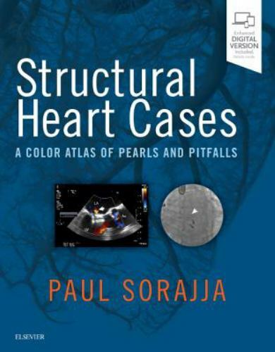 Structural Heart Cases : A Color Atlas of Pearls and Pitfalls, Hardcover by S…