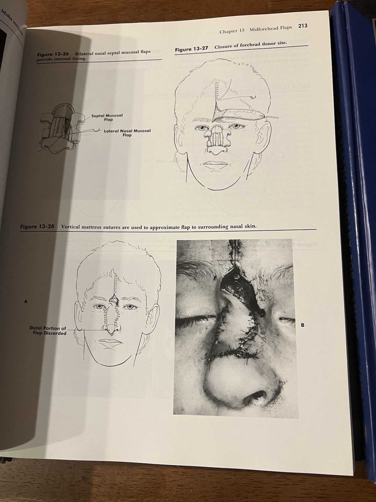 Lot Of 3 Plastic Surgery And Reconstruction Books
